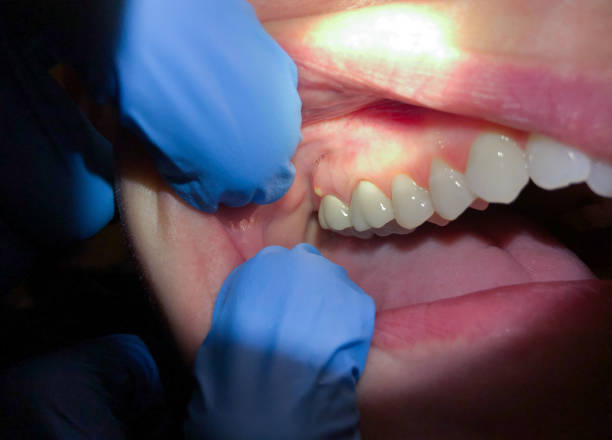 Best After-Hours Dental Trauma Care in Williamsburg, VA